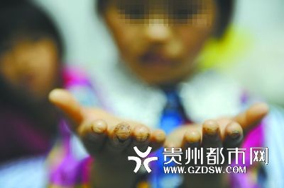 指尖被針扎得傷痕累累。