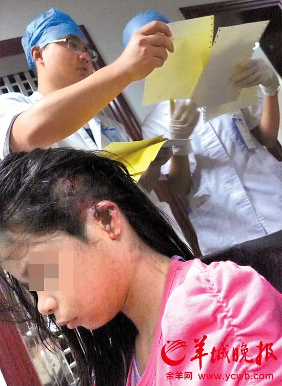 受傷的11歲女孩頭發(fā)被卷入扶梯，耳朵被嚴重拉傷，需手術。
