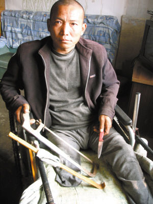 鄭艷良就是用這幾樣簡陋工具，給自己做了右腿截肢手術(shù)。