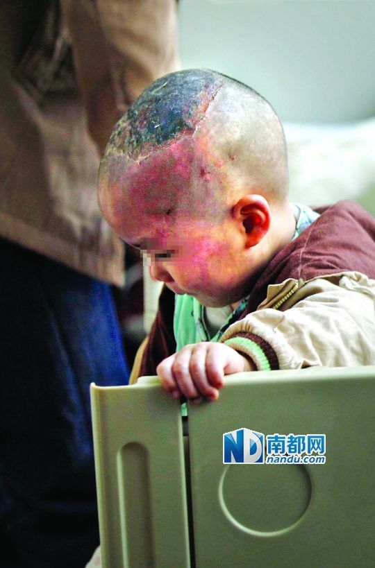 1月8日下午，小寶頭上和臉上都是傷痕。