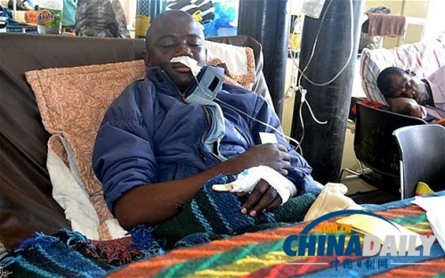 雖然已經(jīng)在醫(yī)院接受了近一個(gè)月的恢復(fù)治療，卡托卡的身體仍然非常虛弱。
