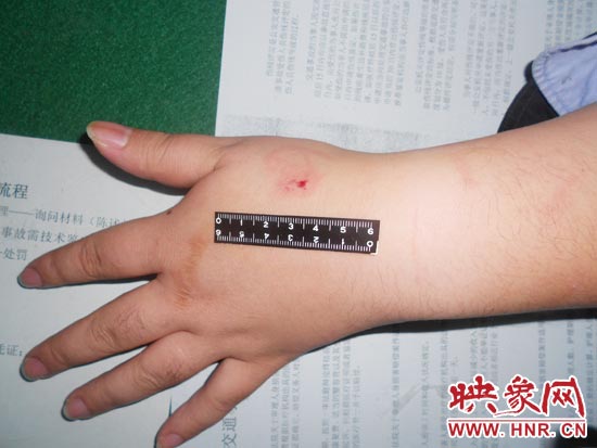 為幫助無證駕駛的朋友逃避處罰，新鄉(xiāng)的王某竟對(duì)執(zhí)勤民警大打出手，還將一名民警的手臂咬傷