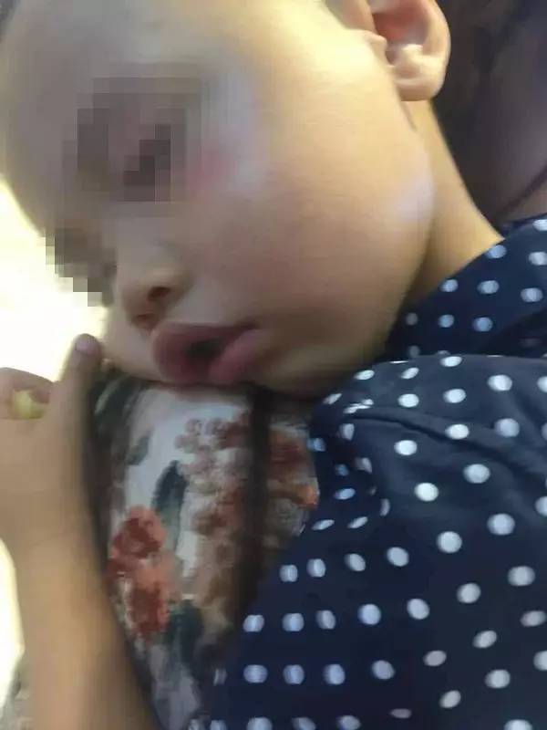 2歲娃店門口被一女子打 當(dāng)場后腦勺著地鼻子出血