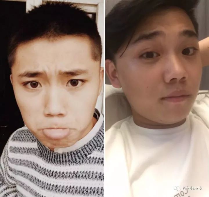 長胖20斤，臉型怎么變？這些例子看完扎心了！