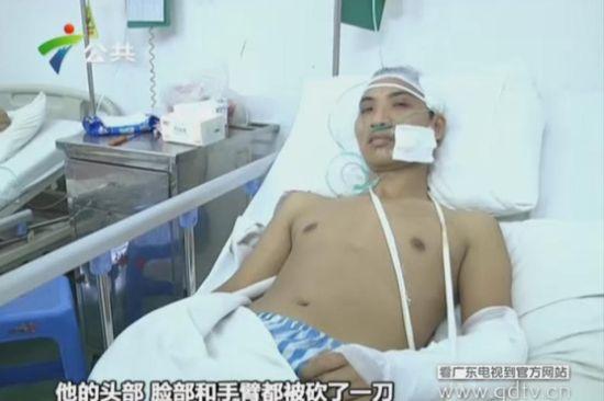 另一名傷者頭部、臉部和手臂都被砍了一刀。(視頻截圖)