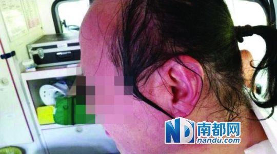 涉事教師遭熱水潑臉后的照片。