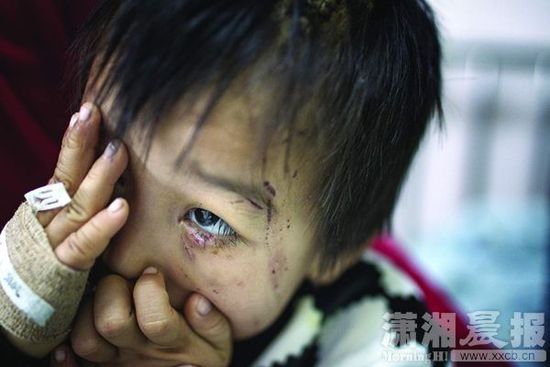 1月13日，湖南省兒童醫(yī)院，4歲的源源用手蒙住了眼睛。