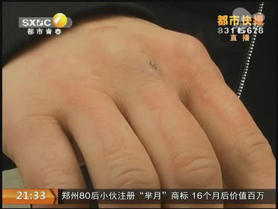 說到這足療拔罐，估計大伙都不陌生，但是想起4號晚上的拔罐的經(jīng)歷，呂先生現(xiàn)在想起來，還心有余悸。