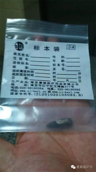 經(jīng)警方鑒定，秦女士體內(nèi)取出的子彈系56式步槍射出 。 受訪者供圖