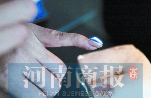 將指甲油涂在指甲上，靠近火焰時被引燃了